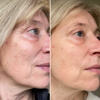 Carousel Slideshow Carousel Slideshow