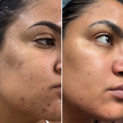 Carousel Slideshow Carousel Slideshow